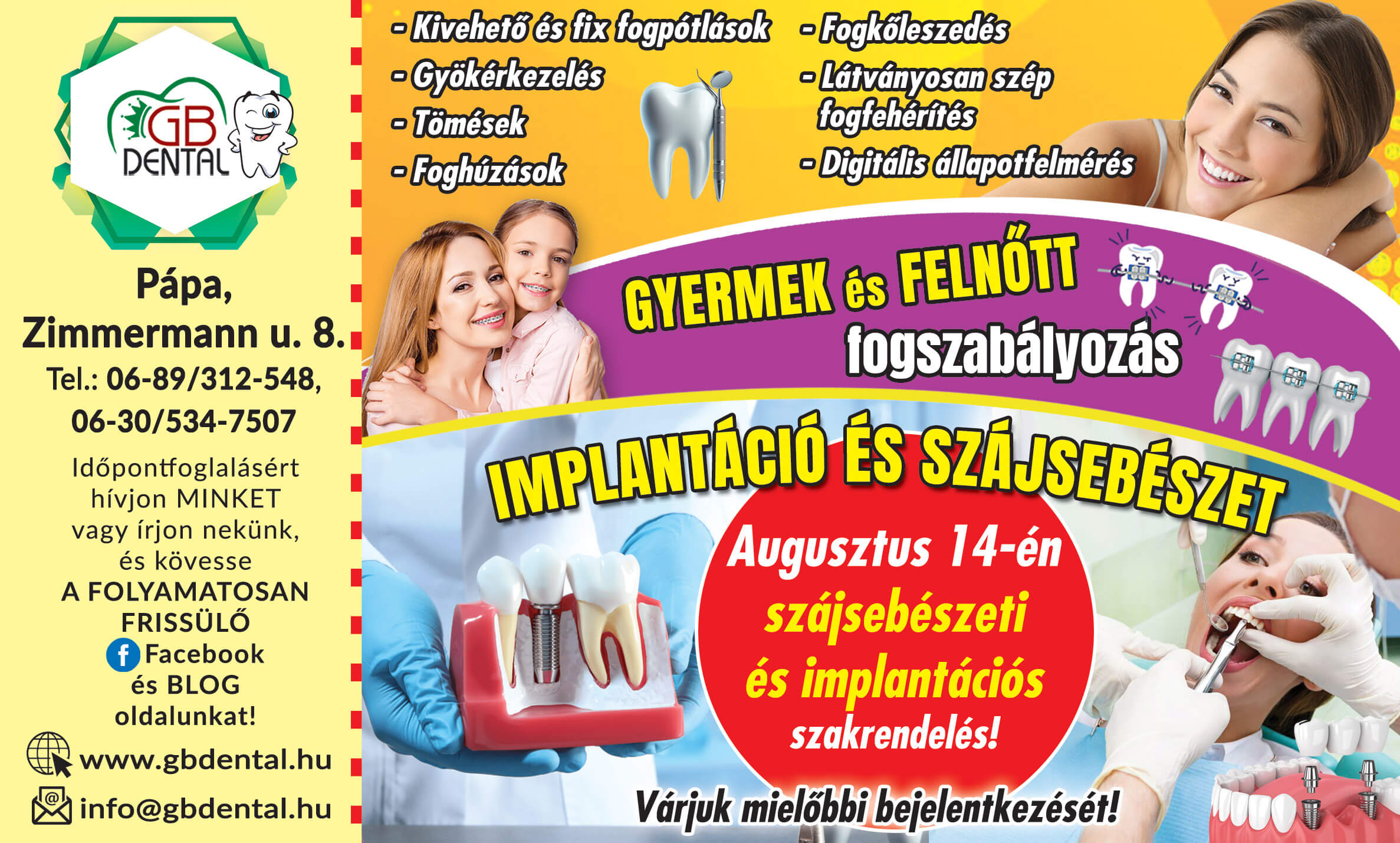 Implantáció és szájsebészet